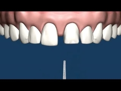 Resistência de corrosão da dentadura do acessório da precisão do CR MK1 do CO