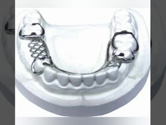 Sistema de varredura Intraoral dental dental da imagem latente da ponte 3D Digitas do laboratório PFM da dentadura