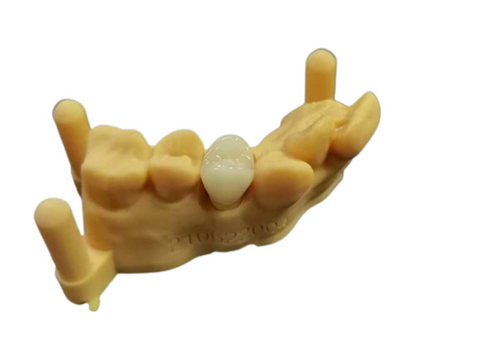 OEM 3D que imprime o projeto dental de Digitas do laboratório da dentadura acrílica flexível