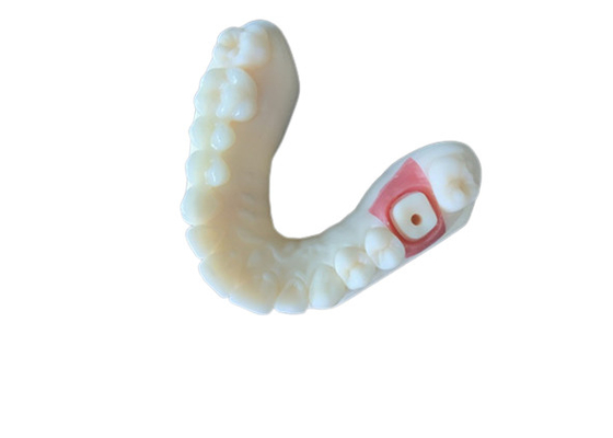 O dente alto da coroa da zircônia da estabilidade PFM mancha resistente para a pesquisa