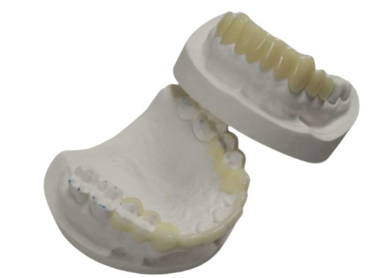 Alta durabilidade CAD CAM Impressão 3D Coroas temporárias Resina durável