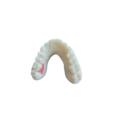 Digitalização Oral Digital PFM Coroas Dentárias Ponte Demandas de Implantodontia