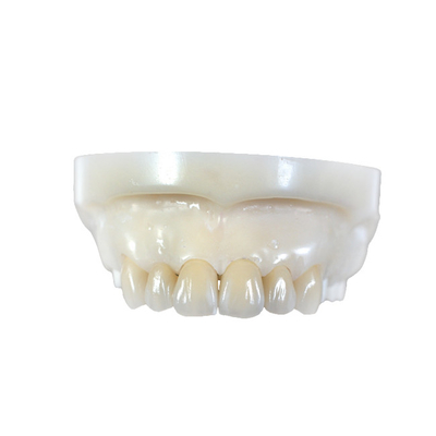 Coroas e pontes de dentes totalmente cerâmicas de zircônio