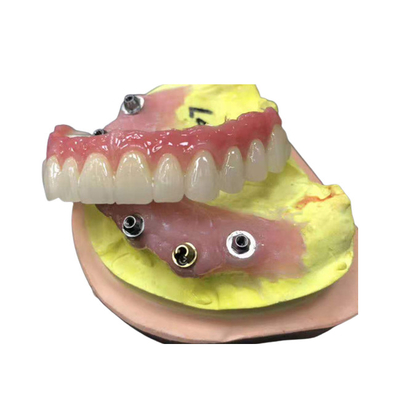Coroa dental da zircônia do limite do implante natural toda em quatro dentaduras