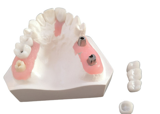 FDA Coroa de zircônio com próteses dentárias implantadas para laboratório dentário