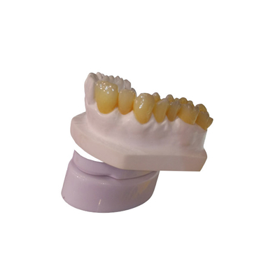 Impressora dental Dental Crowns do laboratório 3D da coroa do projeto PFM do CAD CAM