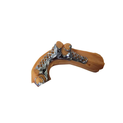 A ponte dental flexível da coroa de Digitas PFM ultra duramente fácil mantém