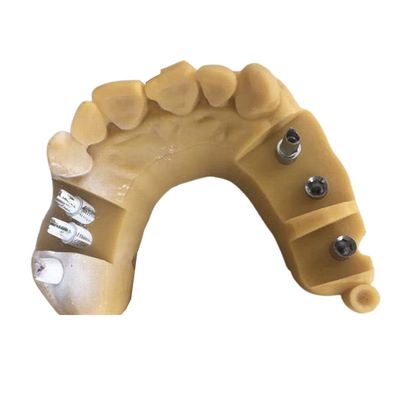 Coroa dental 3D de Digitas Biocompatibility PFM que imprime coroas provisórias