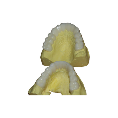 Coroa dental provisória de PFM