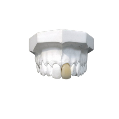 Elevação dental da coroa da boa porcelana de Biocompatibility - material biológico da tecnologia