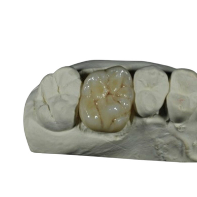 Coroa dental da porcelana flexível do ISO do CE para a restauração dos dentes traseiros