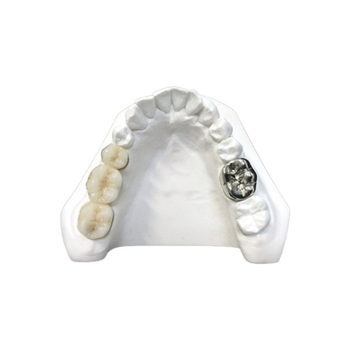 Alto densidade dental da segurança da saúde da coroa da porcelana ultra dura de Digitas