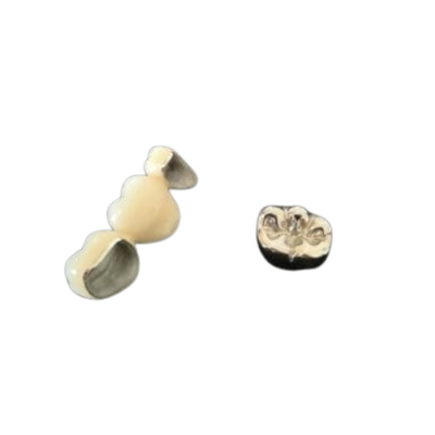 Coroa dental de lustro Intermiscibility biológico alto da porcelana do OEM