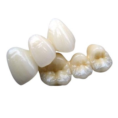 Estabilidade de cor feita sob encomenda da ponte dental cerâmica do Cr 3014652903 de PFM Co