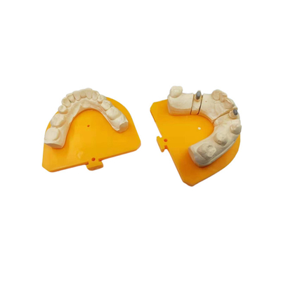 Coroa cerâmica dental da coroa PFM da porcelana de grande resistência do ouro amarelo