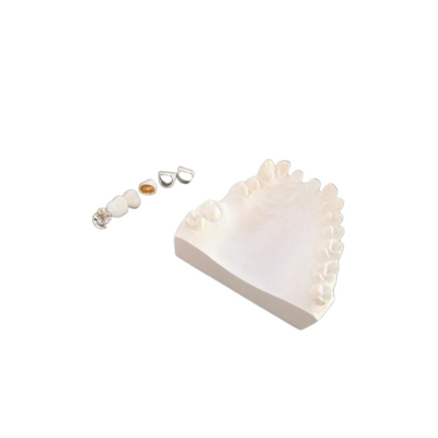 Resistência de corrosão completa personalizada do metal da coroa dental da porcelana de PFM