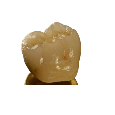 Coroa dental da porcelana inter da miscibilidade