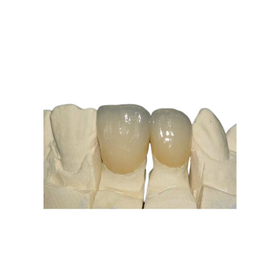 Coroa Metal-cerâmica de superfície lisa de PFM resistente à corrosão