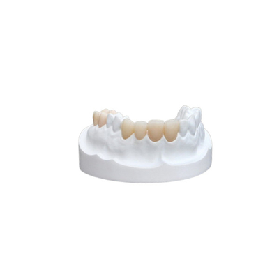 Folheado forte da coroa dental cerâmica dos Onlays dos embutimentos para o departamento dental
