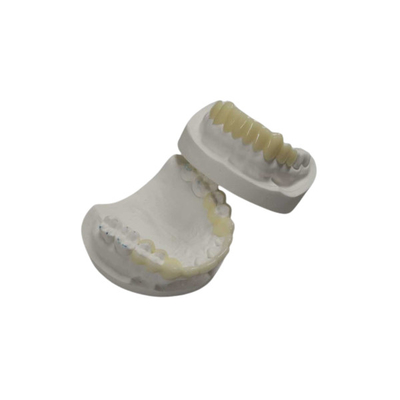 Folheado forte da dureza do Onlay feito sob encomenda do embutimento da coroa do dente da porcelana da temperatura