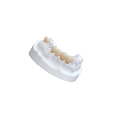 Folheados compostos da porcelana do IPS E Max Ceramic Dental Crown Comfortable