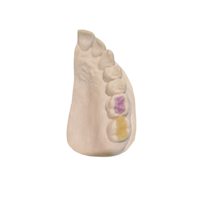 Coroa Todo-cerâmica de FDA da cerâmica dental feita sob encomenda feita sob encomenda do alto densidade