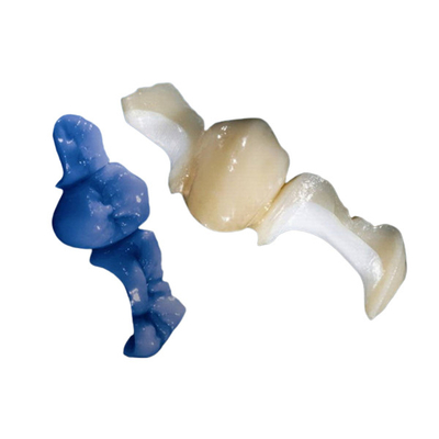 OEM personalizado que lustra o Onlay dental Todo-cerâmico do embutimento do folheado da coroa
