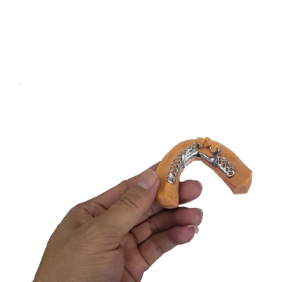 3D que imprime modelos dentais removíveis da estrutura da coroa para a odontologia