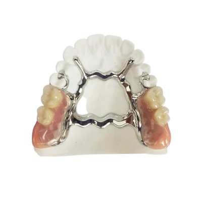 Natrural protege 3D que imprime dentadura removível fixa para o dentista Study