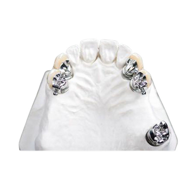 A dentadura parcial do acessório limpo fácil da precisão do OEM mancha resistente