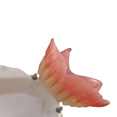 Implante alto da dentadura CAD-CAM do acessório da precisão de Biocompatibility