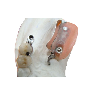 A dentadura duradouro do acessório da precisão do laboratório dental mancha resistente