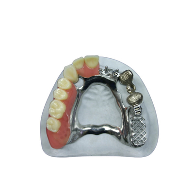 Bela aparência Apego de precisão Prótese dentária Apegos de implantes