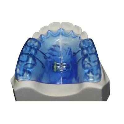 Instrumentos dentais ortopédicos com estabilidade alta e o bom Biocompatibility