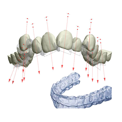 O retentor apoia FDA fixou o dispositivo ortodôntico com 3D