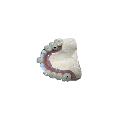 Coroa exata do implante do dente dos acessórios do implante dental de Biocompatibility