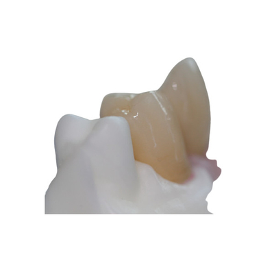 Limite feito sob encomenda da barra pura removível do implante dental do titânio