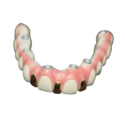 Precisão Digital 3D que imprime o metal da barra do implante dental baseado