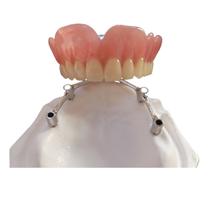 Implantes dentais de FDA da coroa do implante do dente de COCR com barra do titânio