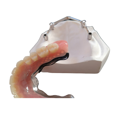 Barras de implantes dentários de titânio/titânio puro para Centro Digital CAD CAM