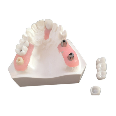 Boa barra inter biológica do implante dental da miscibilidade com aprovação de FDA