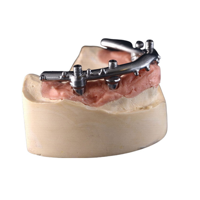 O implante do CNC do titânio All-On-4 fixou dentaduras para a clínica dental