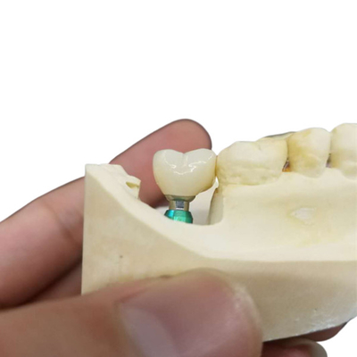 Aprendizagem contínua educando a comunidade dental