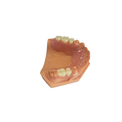 3D imprimiu dentaduras para os laboratórios dentais baseados em dados de Digitas