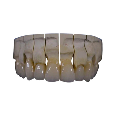 A zircônia dental da restauração da coroa da zircônia completa da boca fixou a resistência química da ponte