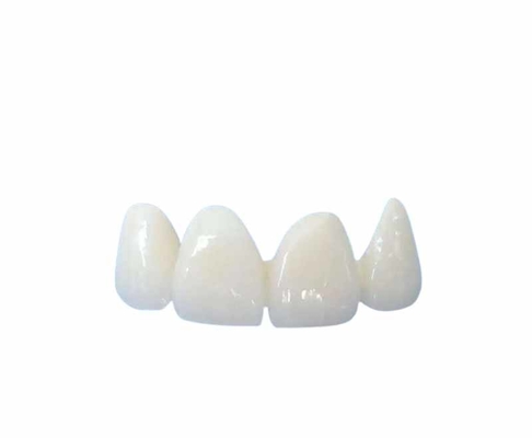 Fácil limpando todo o cerâmico coroa a máscara natural transparente customizável