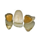 Resistência de desgaste lisa da coroa da porcelana do metal da coroa dental da restauração PFM