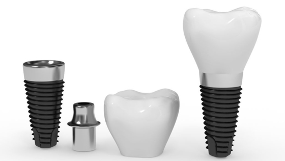 Barra natural do implante dental da vida útil longa artificial segura segura do implante da raiz