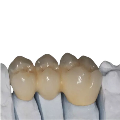O OEM personalizou os bens de grande resistência dos dentes da porcelana da zircônia bonitos