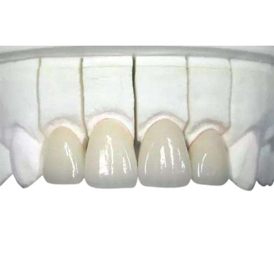 3D imprimiu o desgaste dental da coroa da zircônia - altamente Biocompatible resistente